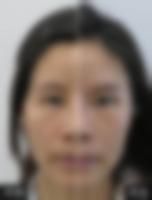诊疗特色总结:广州医学校第二附属医院整形美容中 心张梅英
