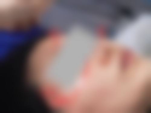 患者真实评价:徐州予美整形医疗美容医院刘婉的口碑见证