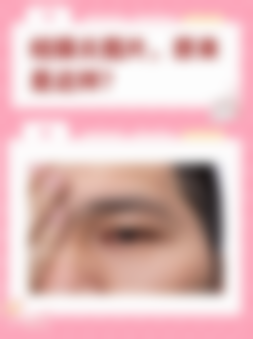 常见问题解答