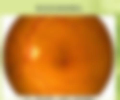 临床实例分享