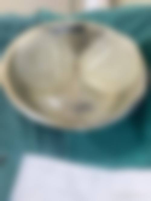 临床实例分享：曾水刚医生真实治疗成效