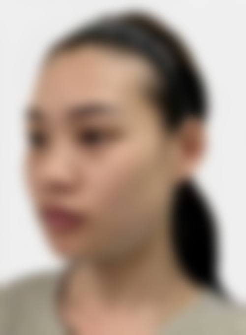 临床实例分享