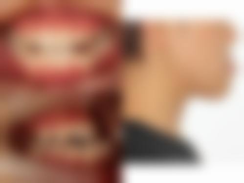 诊疗特色总结:昆明拜博口腔医院周莉医生预约方便吗?