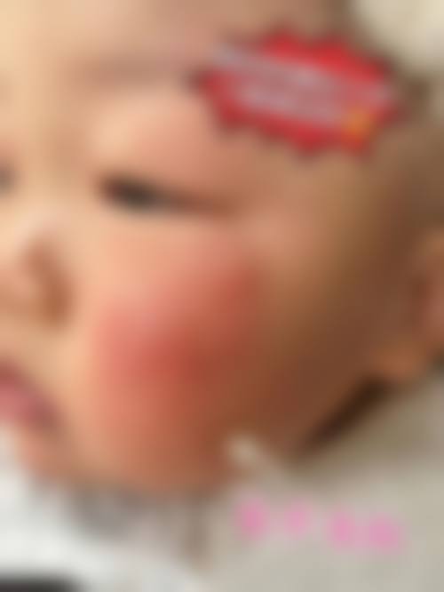 患者真实评价