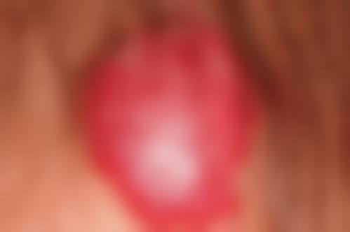 预约优惠活动