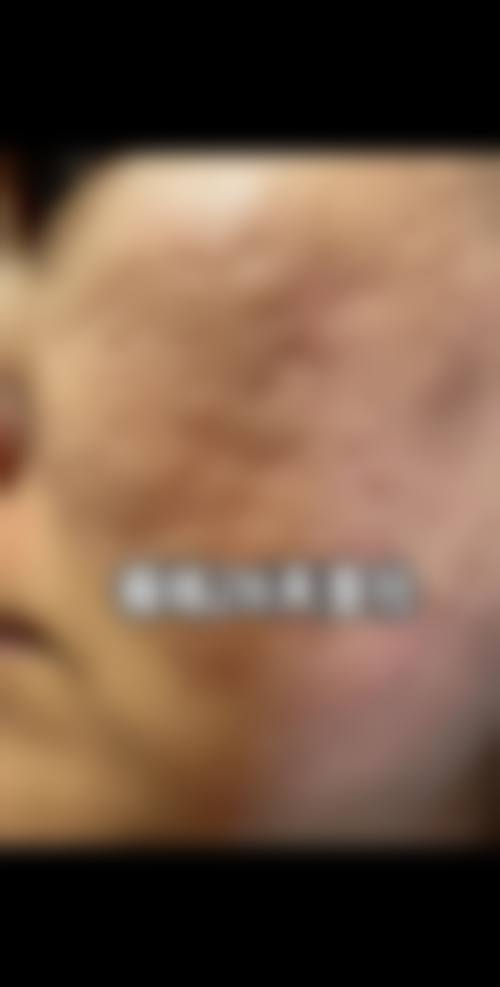 擅长项目详解