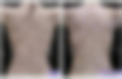 预约优惠活动：福州曙光整形美容医院任海英的专属补贴