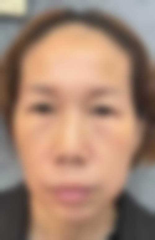 预约优惠活动：北京圣心医疗美容诊所许士海