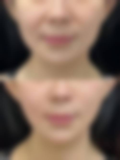 常见问题解答与预约指南