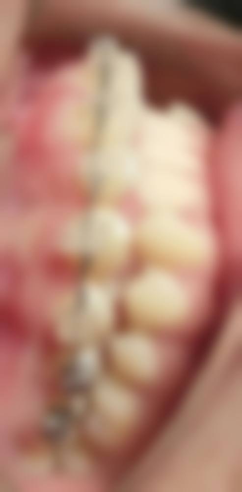 预约优惠活动