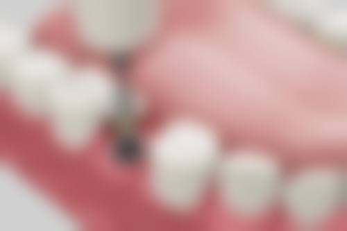 诊疗特色总结:北京贝杰口腔门诊部的技术优势是什么?