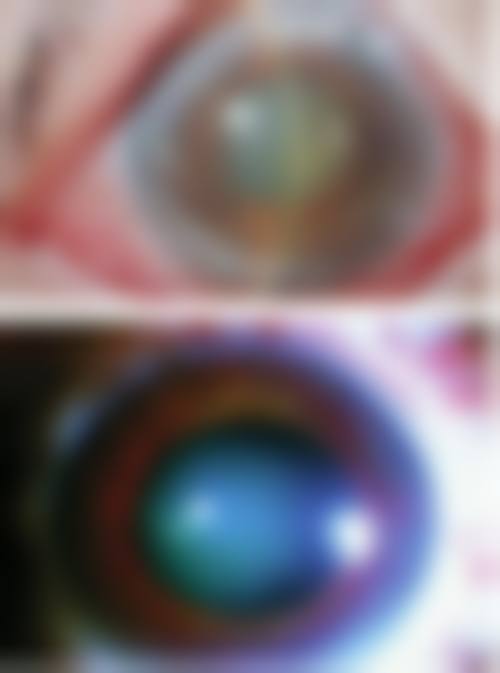 诊疗特色总结:为什么选择湘雅医院眼科?