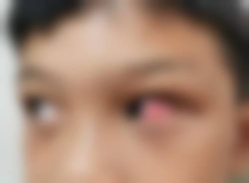患者真实评价:信赖源于细节