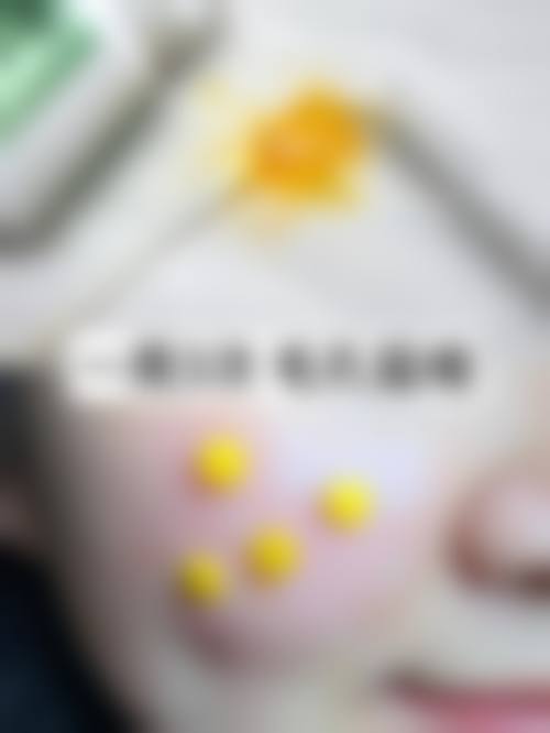 精良医疗设备与标准化手术环境