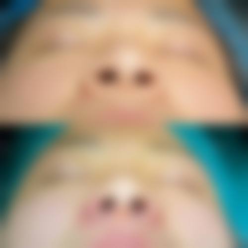 总结与预约号召