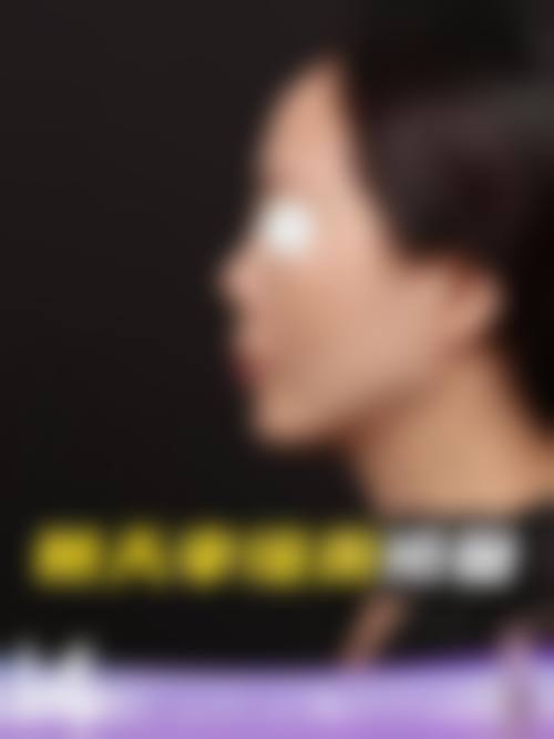 精良设备与层流环境保护治疗安心