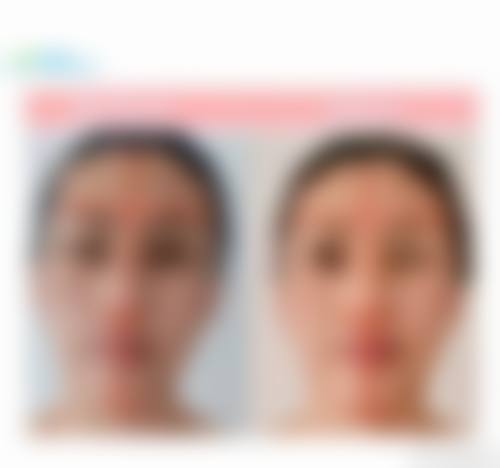 预约优惠活动：限时补贴不容错过