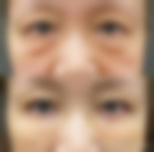 结尾预约号召:把握机会重拾清晰视界