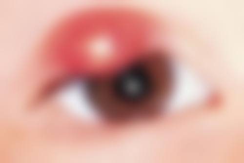 临床实例分享：邓志峰+菏泽市中医医院眼科+核心项目