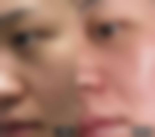 FAQ:深圳美疤克整形(福田壹秀店)朱永洪