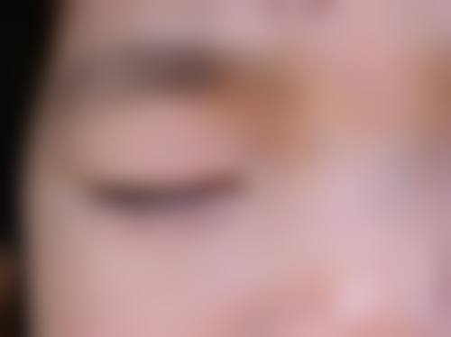 擅长项目详解:精细诊疗覆盖全眼科领域