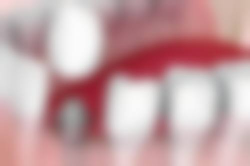 昆明昆安口腔时代天使隐形矫正12800元起项目的技术优势有哪些？