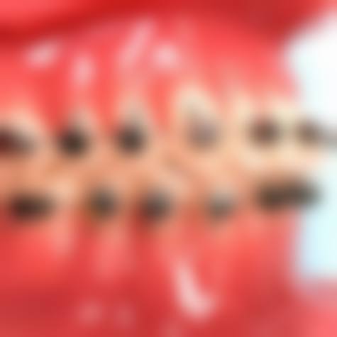 临床实例分享杭州皓泽口腔李建家