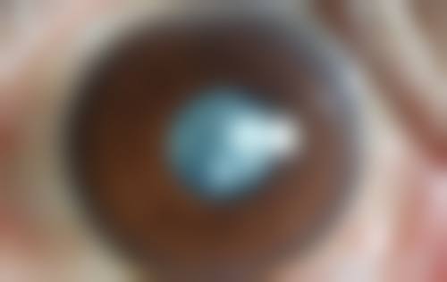 擅长项目详解天津中 医 药大学第一附属医院眼科黎红梅