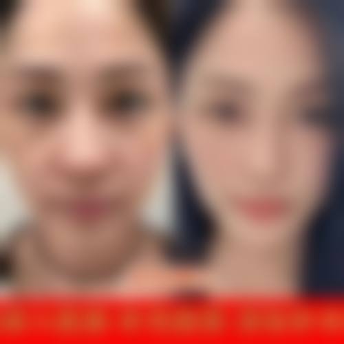 常见问题解答:消除顾虑,安心变得更美