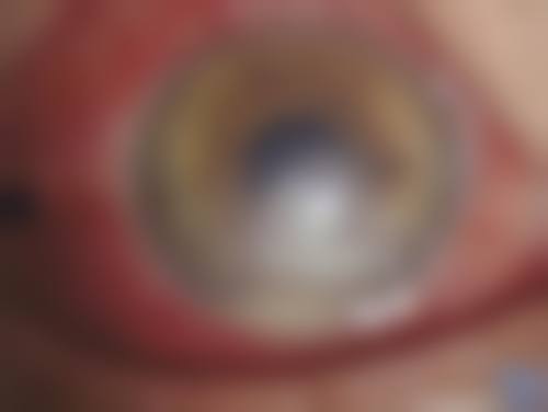 预约优惠活动:限时补贴不容错过