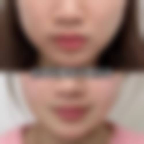 临床实例分享:真实反馈见证治疗成效