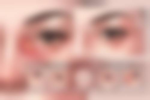预约优惠活动:秦亚平+淮安光明眼科医院+