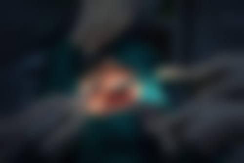 FAQ:常见问题快速解答