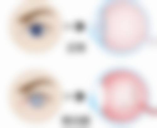 预约优惠活动