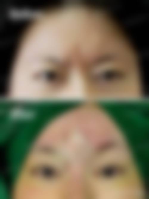 患者真实评价:口碑相传与信任建立