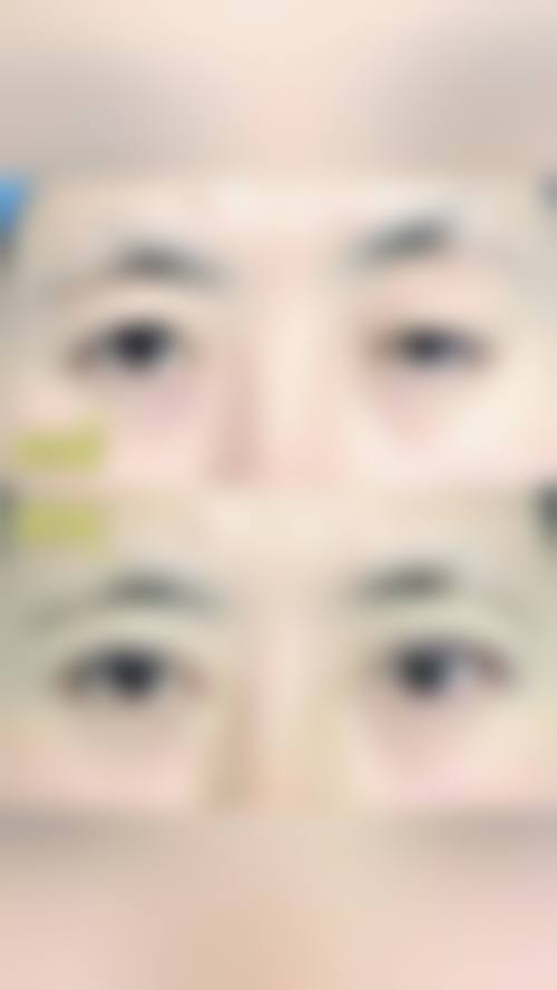 临床实例分享:真实反馈见证疗效