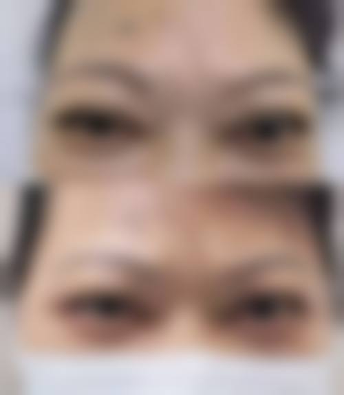 临床实例分享中南大学湘雅医院眼科谭浅