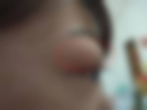 FAQ中南大学湘雅医院眼科谭浅