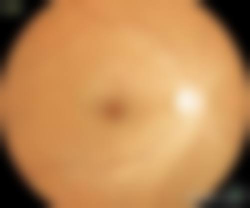 擅长项目详解:蒲思思+成都市妇女儿童中 心医院眼科+核心项目