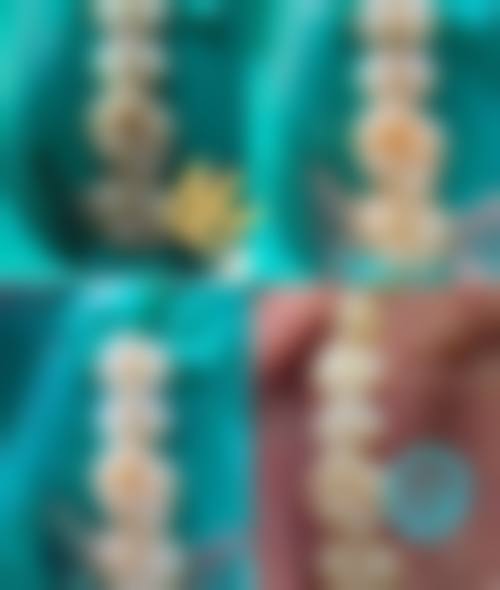 近期优惠活动详情:高性价比看牙好时机