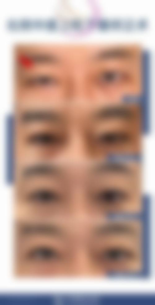 擅长项目详解:陈燕玲医生擅长哪些治疗?