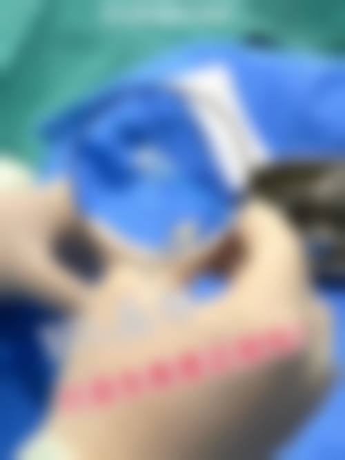 临床实例分享