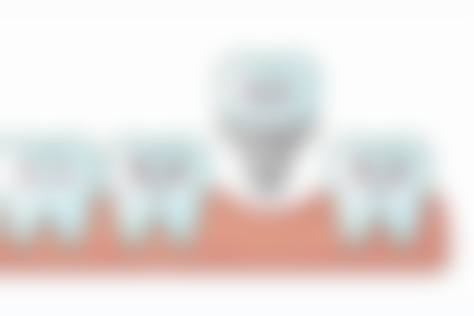 结尾预约号召：把握机会，重拾口腔健康