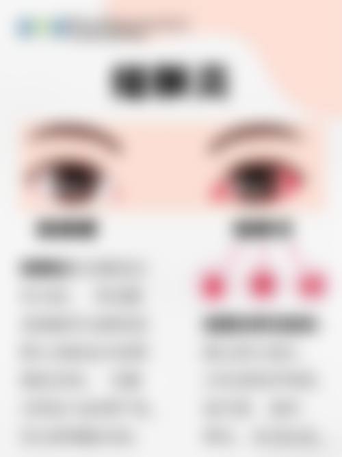 结尾预约号召:昆明红会医院眼科胡竹林