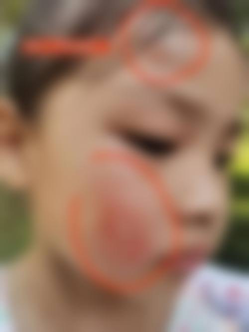 擅长项目详解